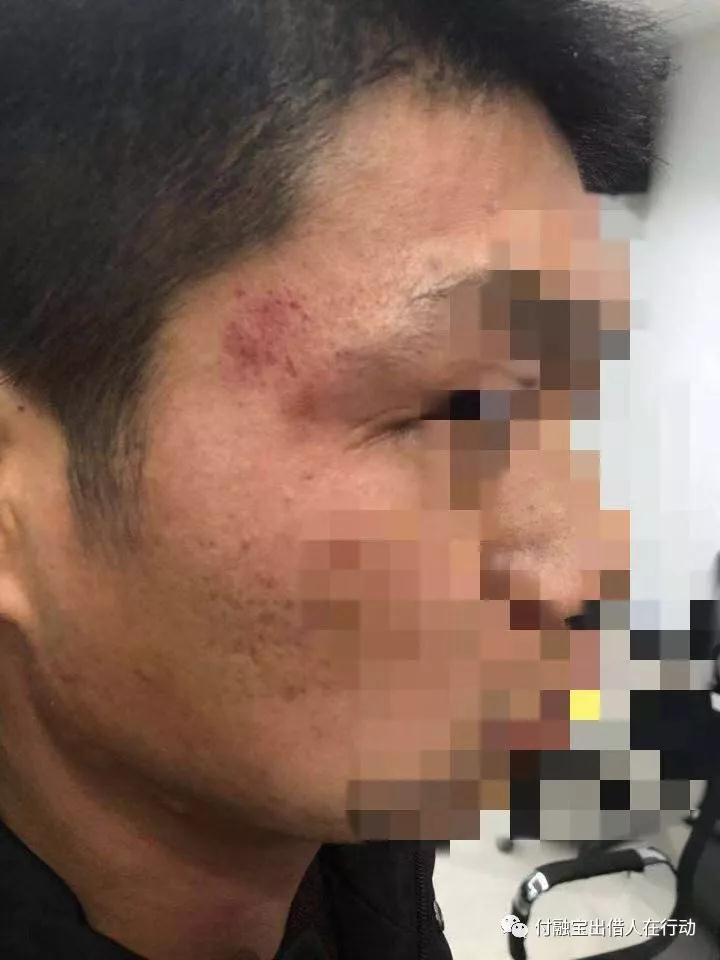 出借人维权被打，付融宝的那些罗生门2