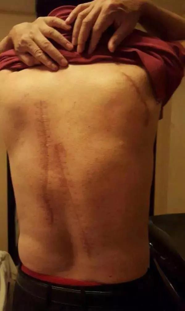 银行董事长当街被砍，420亿骗贷案一审宣判，揭开背后的血腥与罪恶2